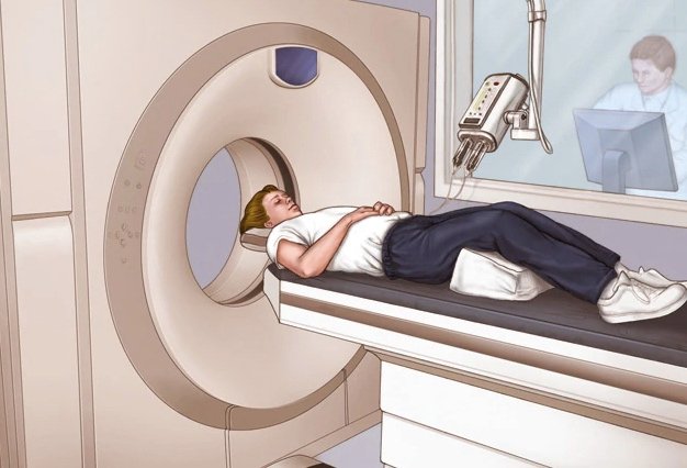 CT扫描使用一系列X射线来捕获身体的横截面图像